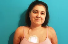 "Choroba była dla mnie zbawieniem". 27-latka o walce z białaczką