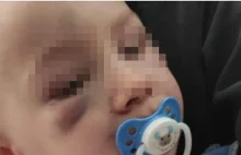 Łódź. 2-letni Aleks pobity, obok zakrwawionego chłopca leżała jego naga matka