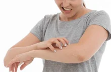 Atopowe zapalenie skóry – jakie są objawy i jak leczyć?