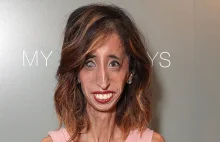 Lizzie Velasquez (najbrzydsza kobieta świata) miała ok. 30 narzeczonych