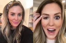 Influencerka OSZPECONA po nieudanym botoksie: "Wyglądam jak Dwie Twarze!"