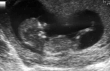 Większość biologów popiera aborcję nie mając wątpliwości, że jest to uśmiercenie