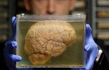 Jak komorki mozgowe naprawiajac swoje DNA pokazuja ogniska starzenia i chorob