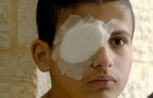 Żydowscy "żołnierze" postrzelili palestyńskiego chłopca w głowę - stracił oko.