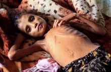 400 tysięcy dzieci w Jemenie może w tym roku umrzeć z głodu