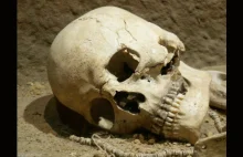W średniowieczu aż 15% zmarłych mogło umierać na nowotwory