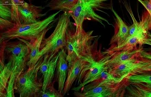 Przełom w obrazowaniu żywych komórek – mikroskopia sił atomowych