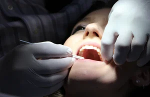 90 proc. Polaków nie stać na dentystę. Co dziesiąty leczy zęby na kredyt