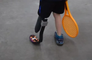 Ortopedzi z Rzeszowa bezpłatnie produkują protezy kończyn dla dzieci -...