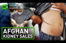 Czarny rynek narządów w Afganistanie - handel nerkami.