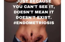 Diagnoza po 16 latach, endometrioza