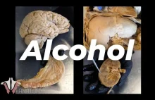 Jak alkohol wpływa na nasz organizm, z autopsji [ENG]