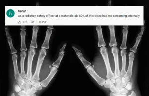 Facet zrobił własny aparat rentgenowski po rachunku jaki dostał od szpitala.