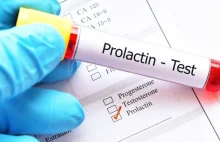 Prolaktyna: co to jest? Jak wygląda badanie prolaktyny?