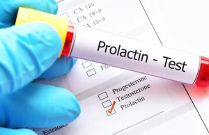 Prolaktyna: co to jest? Jak wygląda badanie prolaktyny?