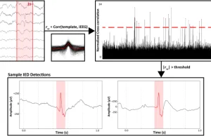 Neurofizjolodzy odkryli mechanizm działania sonaty Mozarta K448 na epileptyków.