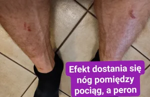 Efekt dostania się nóg pomiędzy pociąg a peron