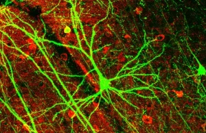 Psylocybina indukuje szybki i trwały wzrost liczby połączeń nerwowych w...