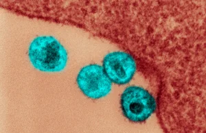 Zidentyfikowano drugiego w historii pacjenta którego organizm sam pozbył się HIV