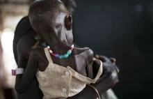 Humanitarny dramat Sudanu Południowego - Magazyn Chrześcijański"FILEO"