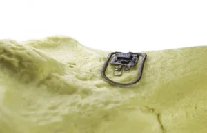 Naukowcy opracowali chip wrastający w kość. Na co pozwoli?