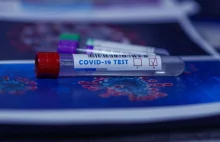 Skierowanie na bezpłatny test przeciw COVID-19