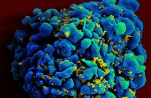 Dlaczego nie mamy szczepionki przeciwko wirusowi HIV?