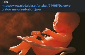 Katolicki Tygodnik Niedziela cieszy się z odmowy aborcji