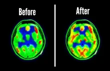 Jak Detox Dopaminowy Działa na Mózg
