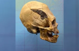 Wydłużona czaszka z metalową płytką sprzed 2 tys. lat. Niezwykłe odkrycie...