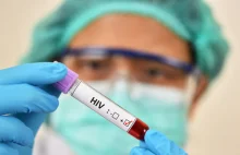 Nowa broń w walce z wirusem HIV?