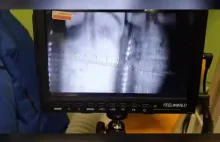 Precyzyjne laserowe spawanie tłumika w podglądzie kamery