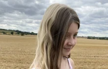 Blondynka czy brunetka? 11-latka urodziła się z rzadkim genetycznym „znamieniem”
