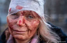 Oto twarz Ukrainy. Zachód musi zareagować.Reporterzy wojenni.