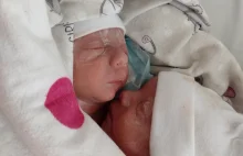 W szpitalu w Gdańsku urodziły się bliźniaki syjamskie! Są zrośnięte brzuchami