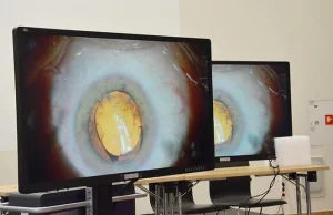 Najbardziej innowacyjny w Polsce sprzęt do operacji okulistycznych w technice 3D