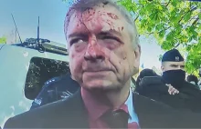 Politycy i dziennikarze przerażeni po oblaniu farbą rosyjskiego ambasadora