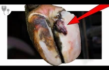 BULBOUS ULCER on COW'S HOOF! ...... HUGELY satisfying