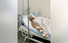 Ukrainiec bestialsko torturowany przez Rosjan. Obcięli mu 4 palce