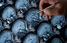 Dwie dekady badań nad chorobą Alzheimera były oparte na oszustwie 2 badaczy