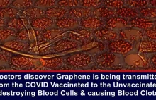 Doctors Discover Graphene Is Transmitted From The COVID Vaccinated To The...