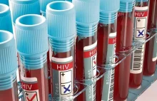 Czternastokrotny wzrost zakażeń HIV w Łodzi w ciągu roku