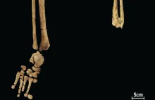 Badania archeologiczne na Borneo- 31 tys. lat temu przeprowadzono amputację nogi
