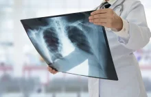 Naukowcy wiedzą, co powoduje raka płuc u niepalących - przełomowe badanie