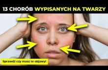 Te choroby poznasz po objawach wypisanych na twarzy i po zmianach skórnych