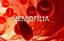 Narodowy Program Leczenia Chorych na Hemofilię