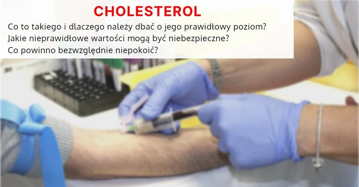 Cholesterol Co To Takiego I Dlaczego Należy Dbać O Jego Prawidłowy Poziom Wykoppl 7624