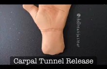 Playdough Surgery - Carpal Tunnel Release