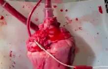 Ludzkie serce podczas etapu transplantacji