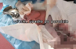 Dziecko upadło po porodzie. Jest w stanie ciężkim